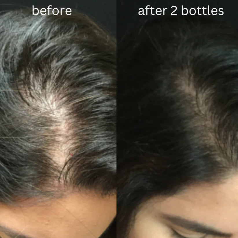 DunePure Organic Rosemary Magic Hair Oil