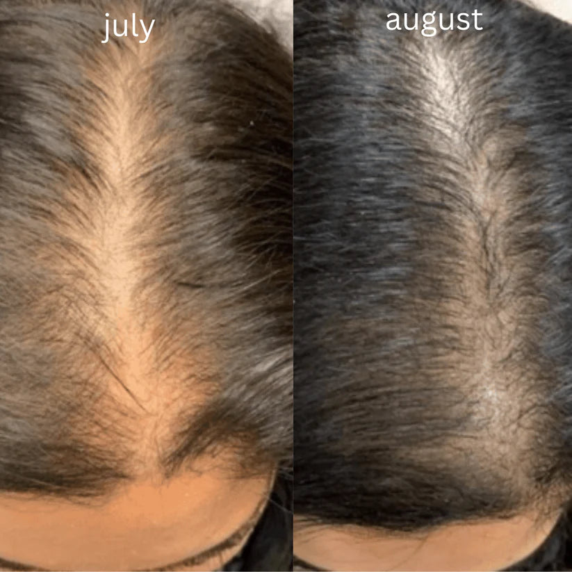 DunePure Organic Rosemary Magic Hair Oil